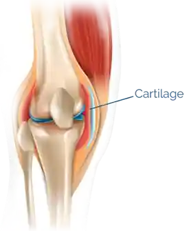 About OA Knee Pain